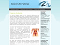 cancer uterus